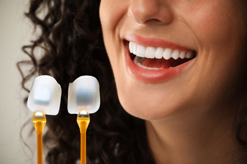 Cosmetic Dental Treatment In Satellite Ahmedabad 