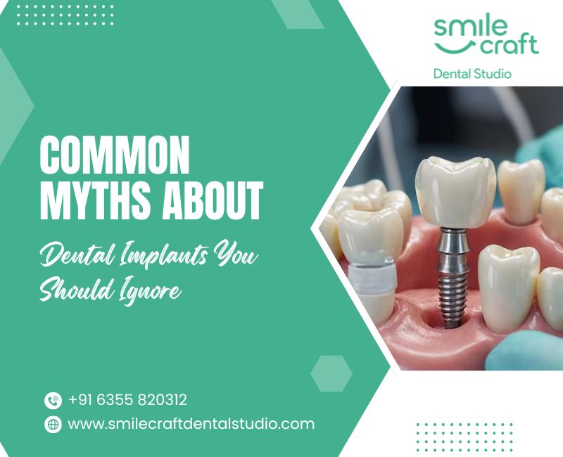 Common Myths About Dental Implants You Should Ignore