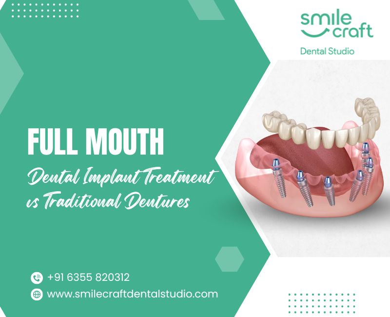 Full Mouth Dental Implant Treatment vs Traditional Dentures