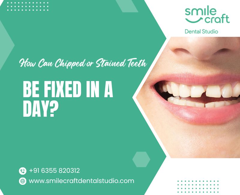 How Can Chipped or Stained Teeth Be Fixed in a Day?