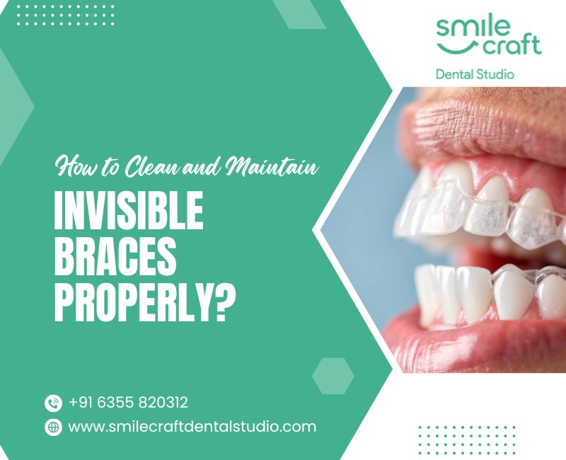 How to Clean and Maintain Invisible Braces Properly?
