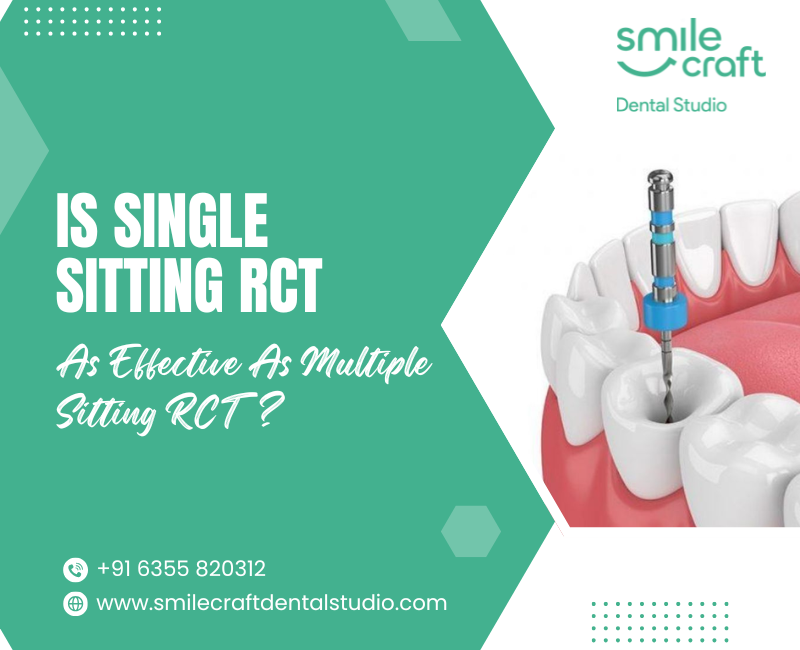 Is Single Sitting RCT As Effective As Multiple Sitting RCT?
